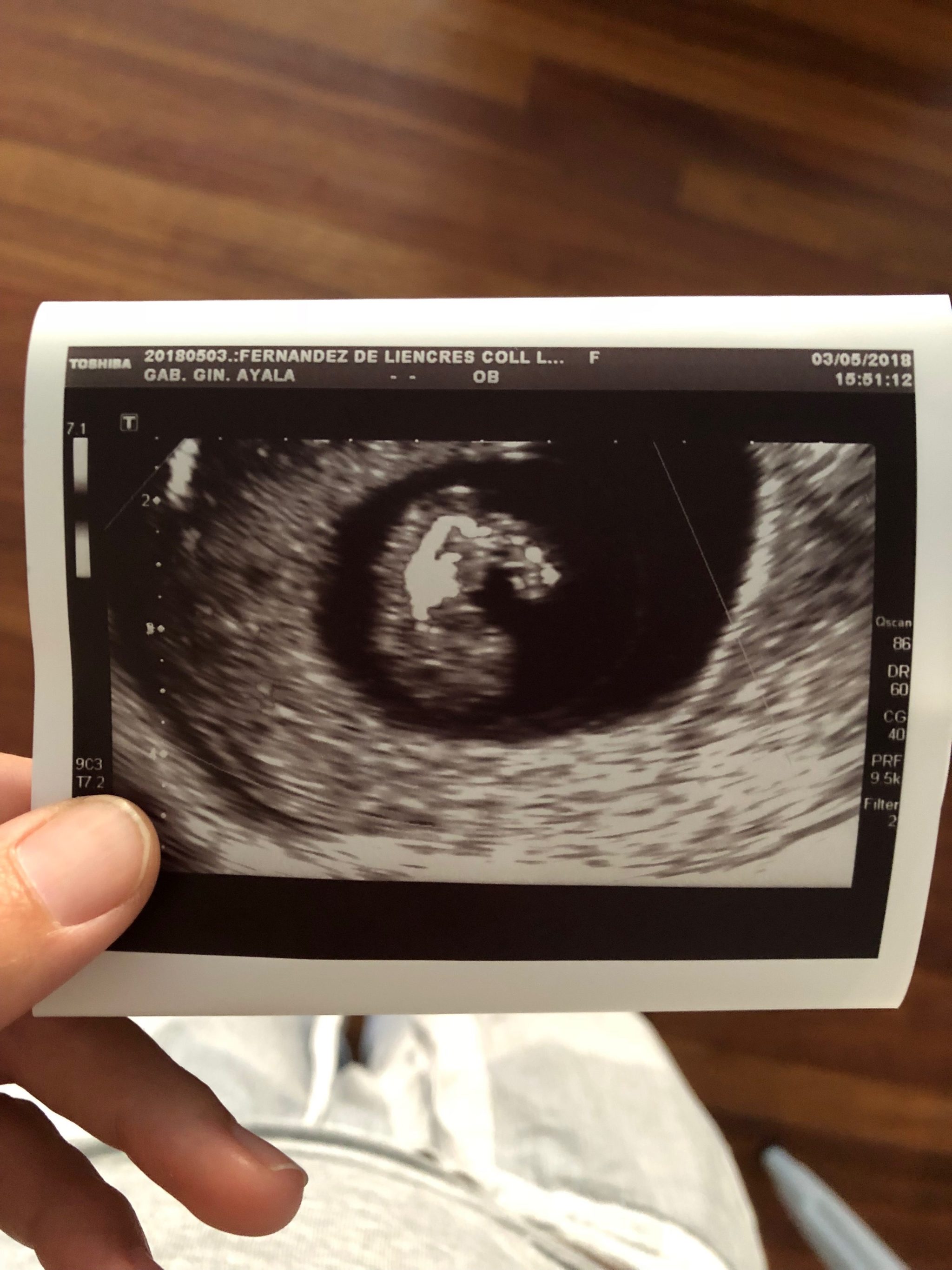 Mi primer trimestre de embarazo